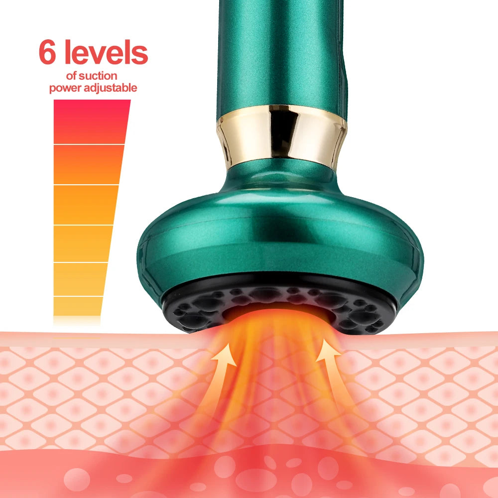 Electric Cupping Massager Device - Z A F L U X X - E M P I R E