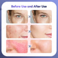 Foreverlily Facial Beauty Massager - Z A F L U X X - E M P I R E
