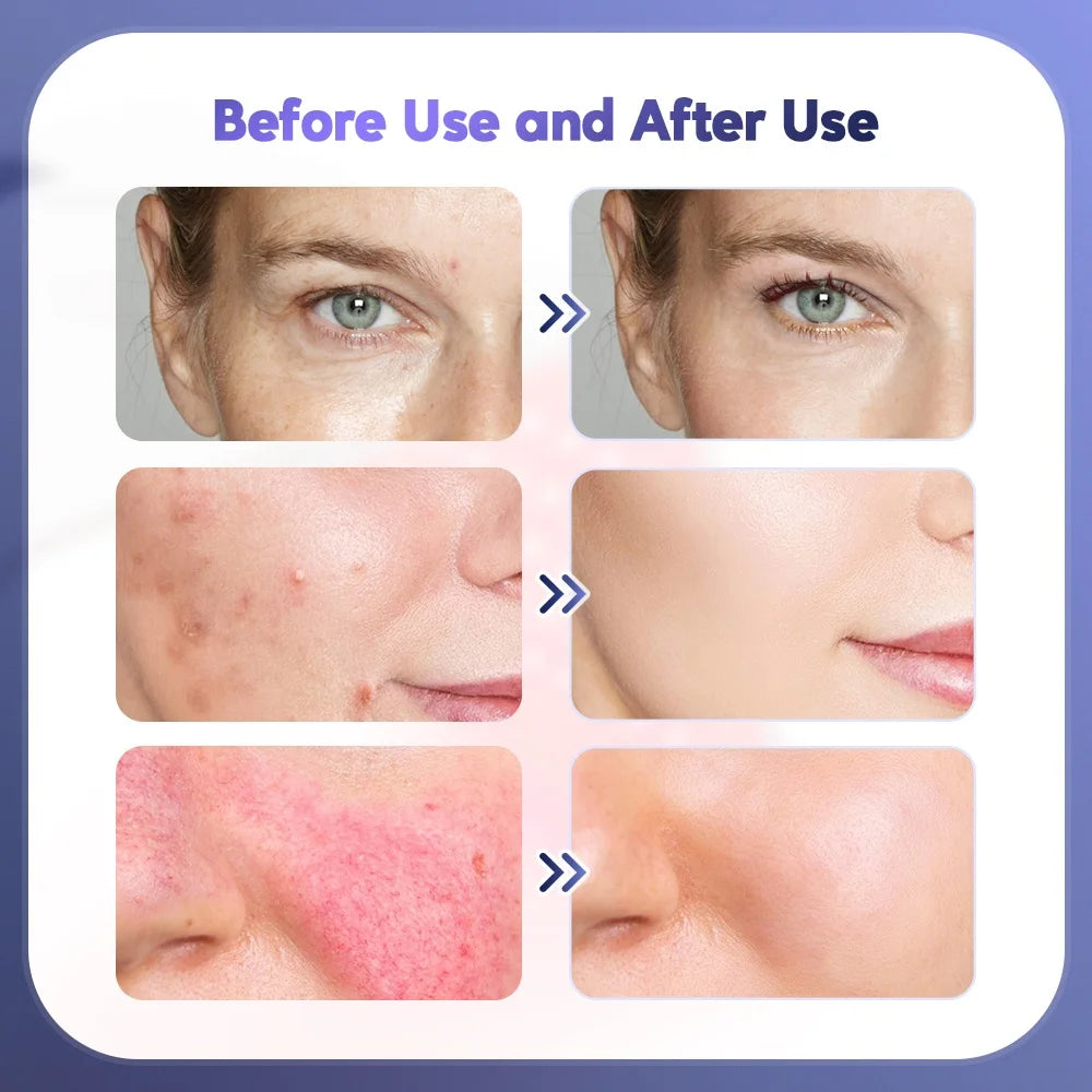Foreverlily Facial Beauty Massager - Z A F L U X X - E M P I R E