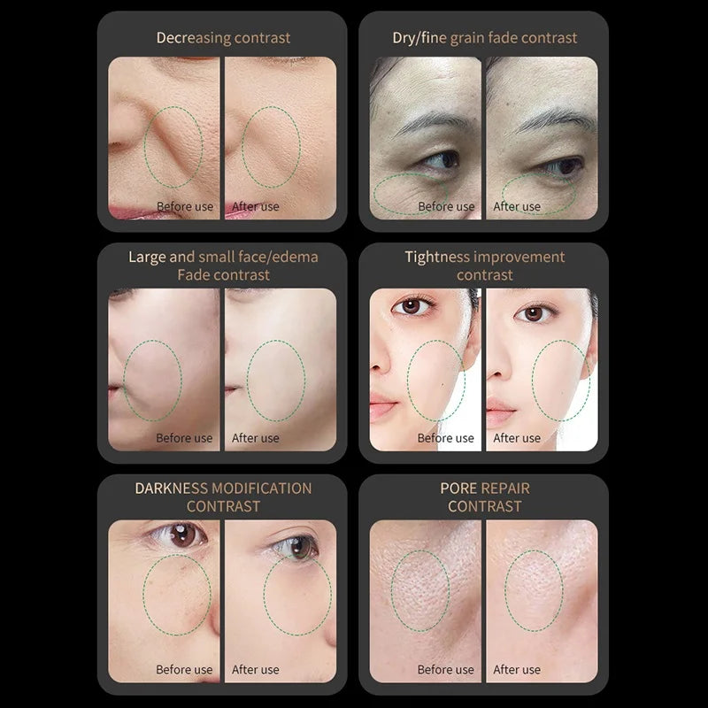 Red Light Collagen Regeneration Beauty Device - Z A F L U X X - E M P I R E